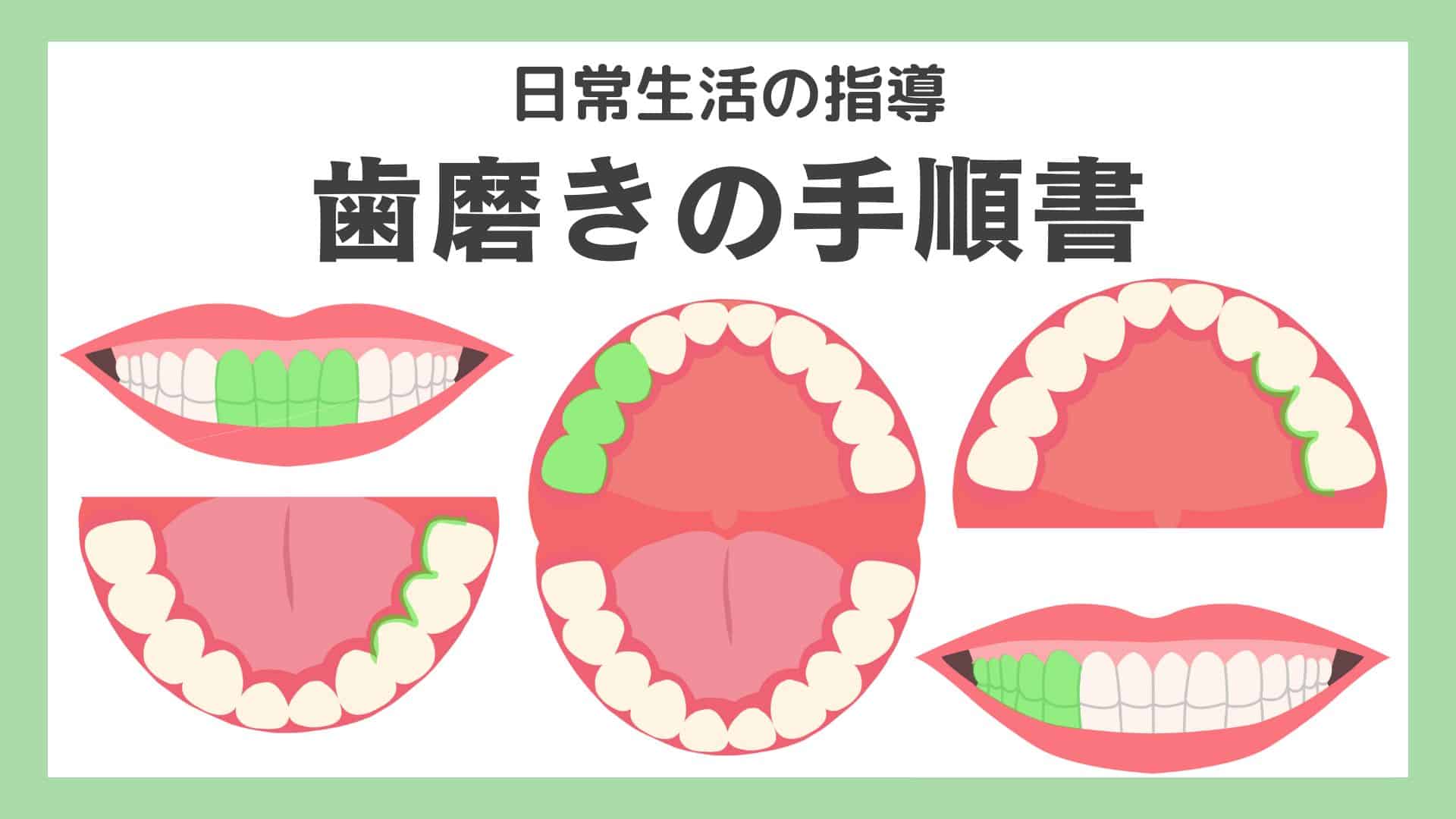 【無料】同じポーズを取るビジョンプリント