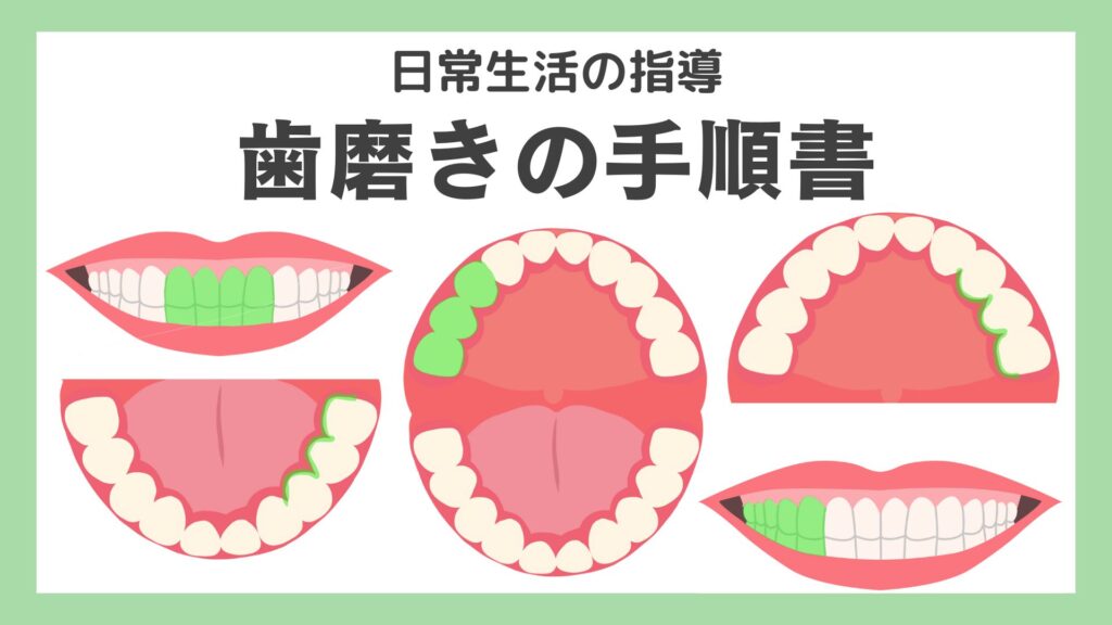 歯磨きの手順書メイン画像